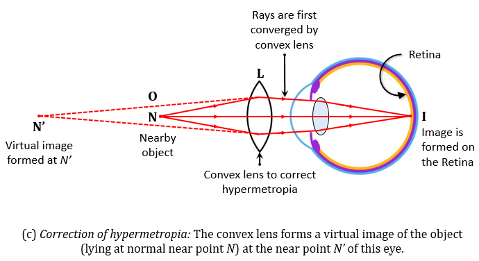 a-what-is-long-sightedness-state-the-two-causes-of-tutorix